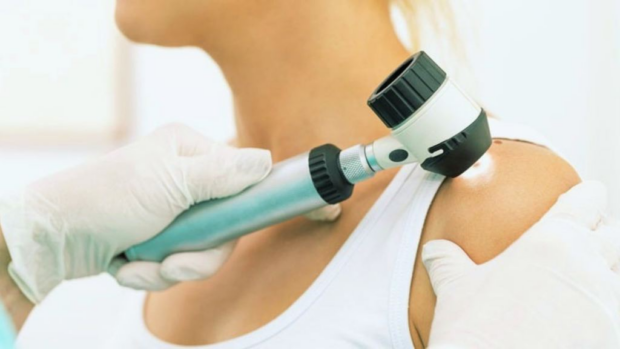 Besplatni pregledi kože širom ZDK: Najveći ciklus do sada, fokus na rano otkrivanje melanoma